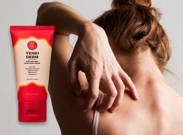 yenki derm before and after psoriasis relief cream